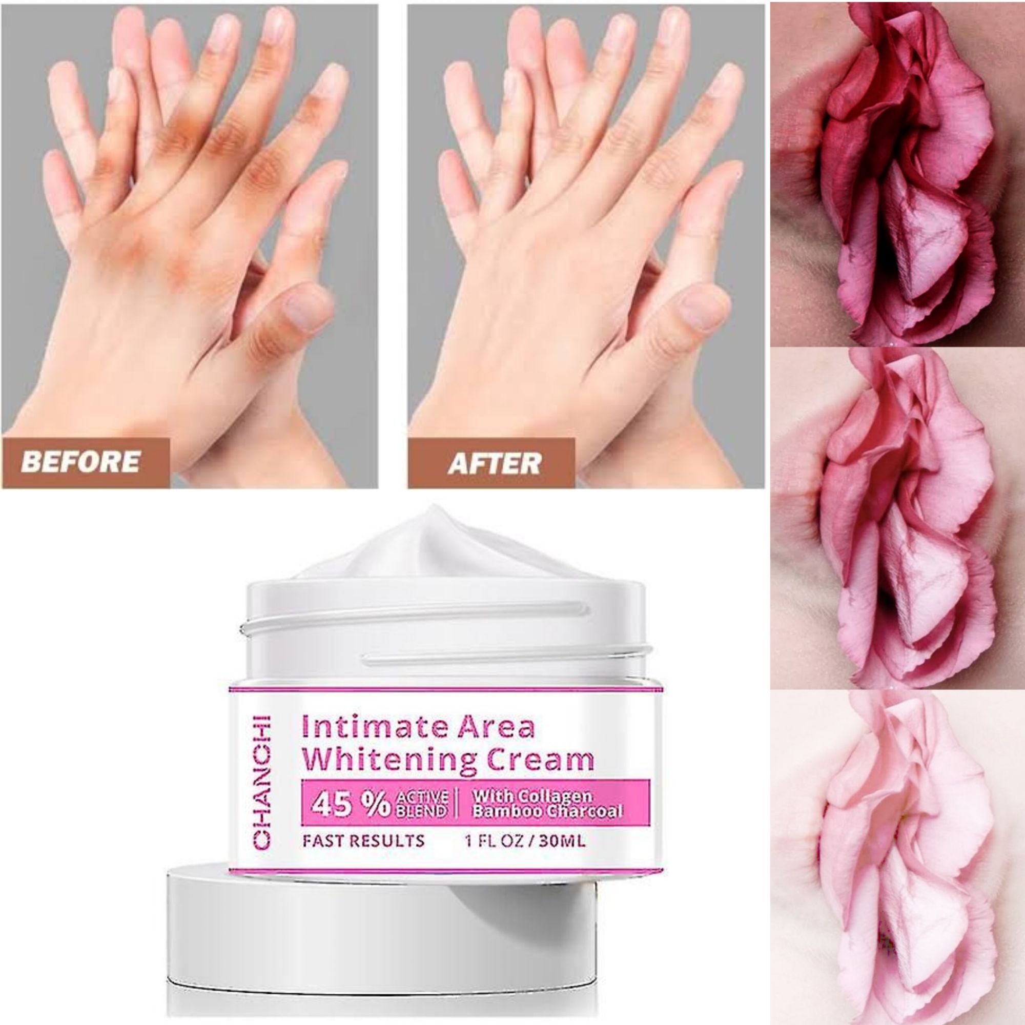 Whitening Cream for Men & Women Skin Brightening, Moisturizing & Dark Spot  Removal Face & Body Lightening Cream for Underarms, Knees, Elbows & Private  Areas | Daraz.pk