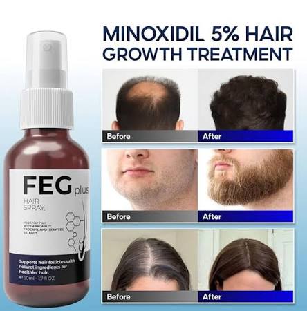Original 100% FEG Hair Growth Spray 50ml – Original Anti Hair Loss Treatment, Fast Hair Regrowth Serum, Thickening & Strengthening Spray for Men & Women