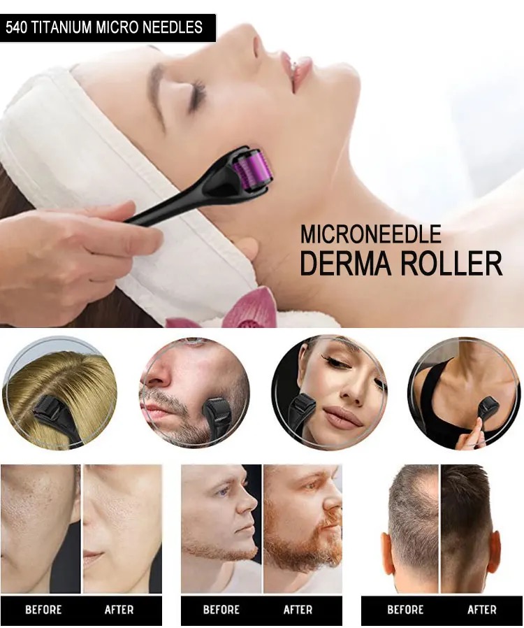 540 Derma Roller Medical Grade Skin Care Microneedling Face Roller Dermaroller for Skin Rejuvenation and Hair Growth | Daraz.pk