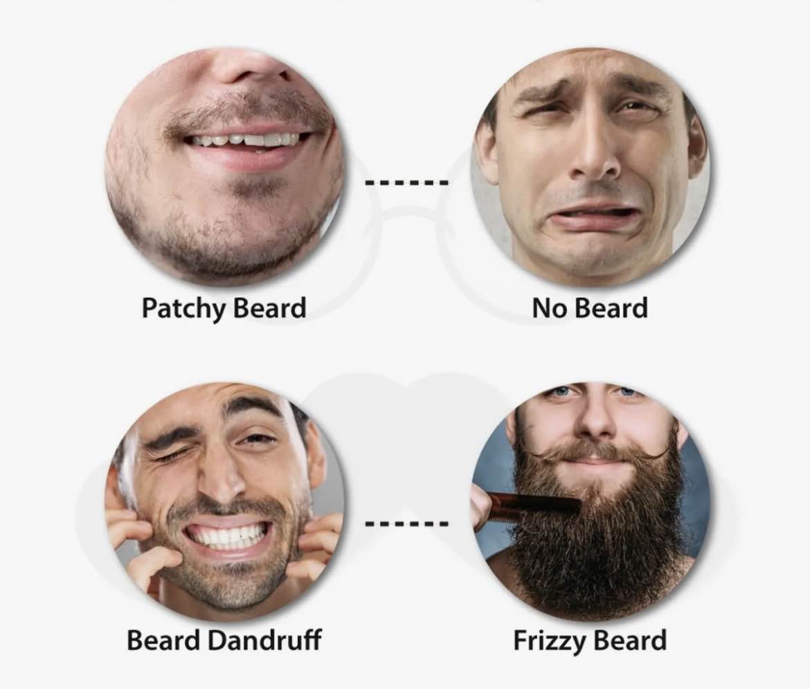 Dr. Alies Professional Beard Growth Oil – 100% Natural Formula for a Thicker & Fuller Beard