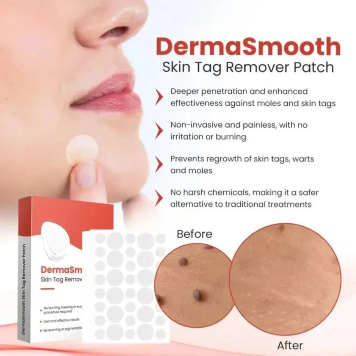 DermaSmooth Skin Tag Remover Patch | Fast, Safe & Painless Skin Tag & Mole Removal | Nano-Microneedle Technology | 72 Patches