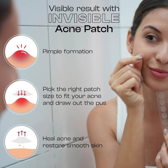 Acne Pimple Patch | Fast-Acting, Invisible Pimple Patches for Clearer Skin | Hydrocolloid Technology | Suitable for All Skin Types