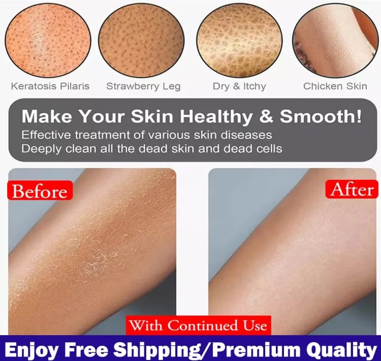 Korean Exfoliating Bath Mitt - photo 3