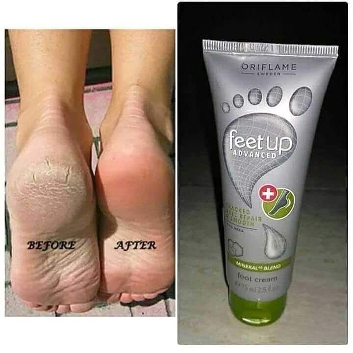 Feet Up Advanced Cracked Heel Repair Cream by Oriflame