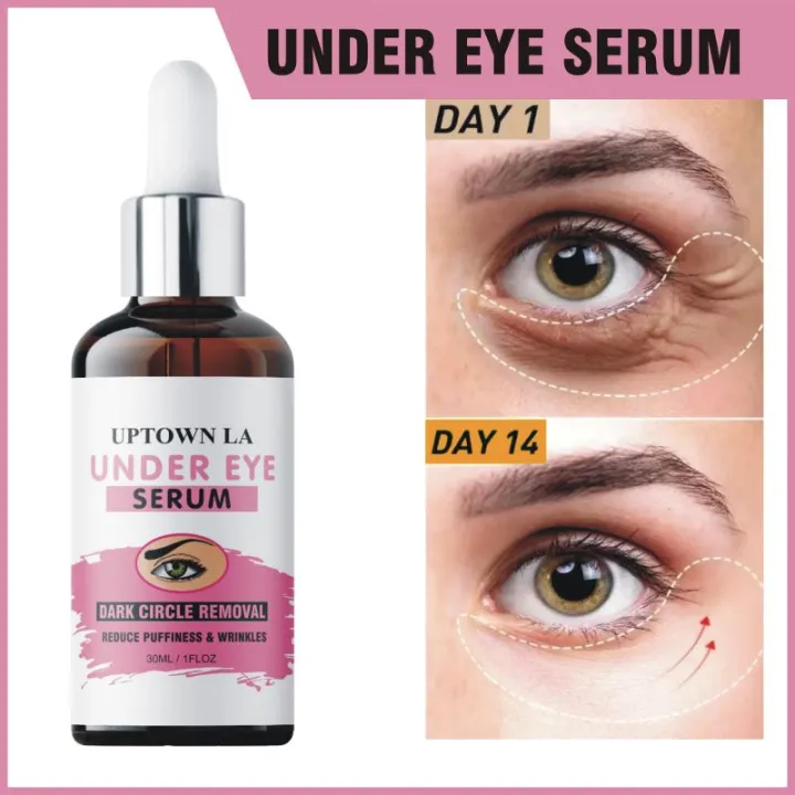 UPTOWN LA Under Eye Serum for Puffiness, Dark Circles, Fine Lines, Anti-Aging and Wrinkle - 30ml