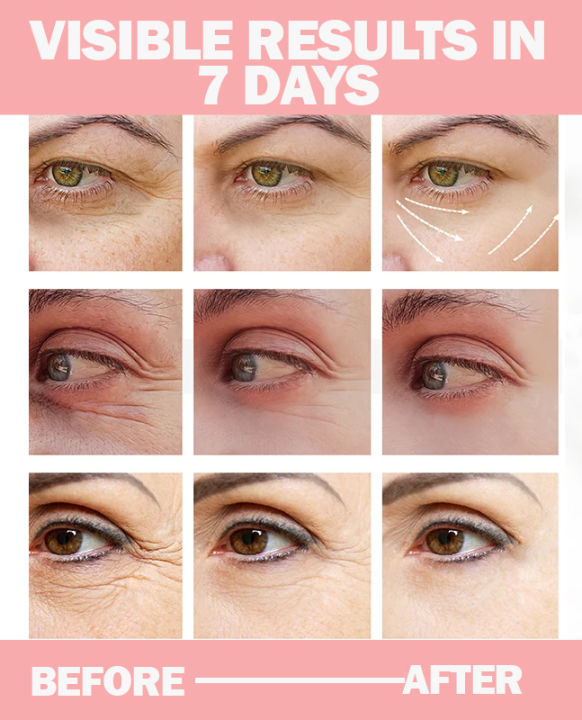UPTOWN LA Dark Circles Under Eye Gel For Brighter and Shiner Eyes
