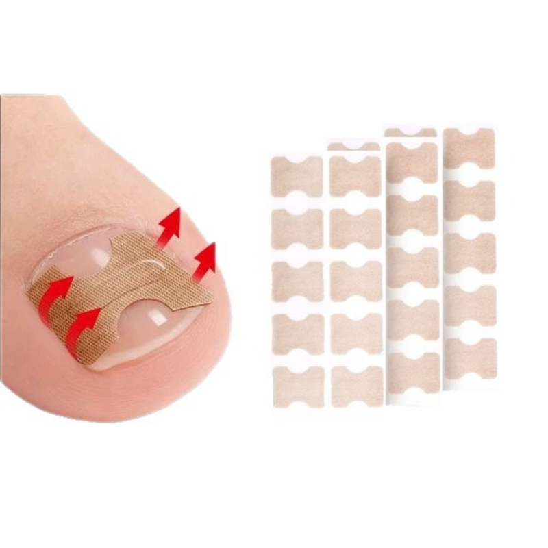 professional Nail Correction Stickers Ingrown Toenail Corrector Patches Paronychia Treatment Recover Corrector Pedicure Tools