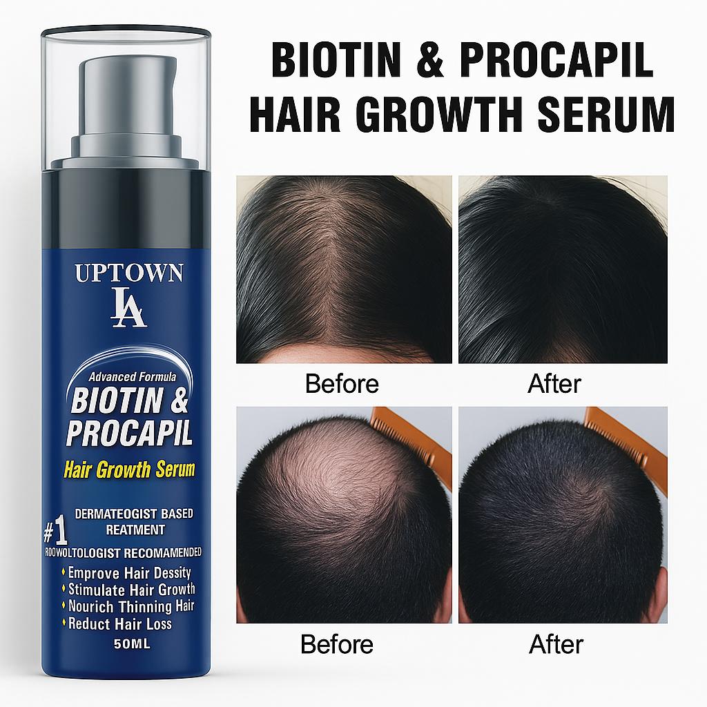 Uptown LA Hair Growth Serum with Biotin & Procapil | Anti Hair Fall Treatment for Men & Women | Thicker, Stronger Hair Regrowth Formula – 50ml