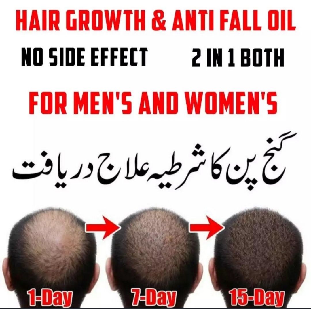 Hair Loss , Hair growth and Regrowth - Pure Hair Oil 100% Working: Buy  Online at Best Prices in Pakistan 