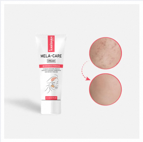 Mela Care Advanced Brightening Cream Mela Care Advanced Brightening Cream.