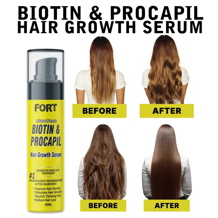 FORT Biotin & Procapil Hair Growth Serum 50ml | Helps Improve Hair Density & Nourish Thinning Hair | Supports Reduced Hair Fall & Stronger Hairs