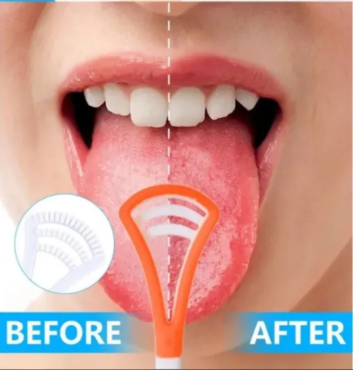 Cleaner Toothbrush Mouth Dental Care Brush Bad Breath Oral Fresher Hygiene Tools Deep Clean For Oral Health Use After Toothbrush For Fresh Breath