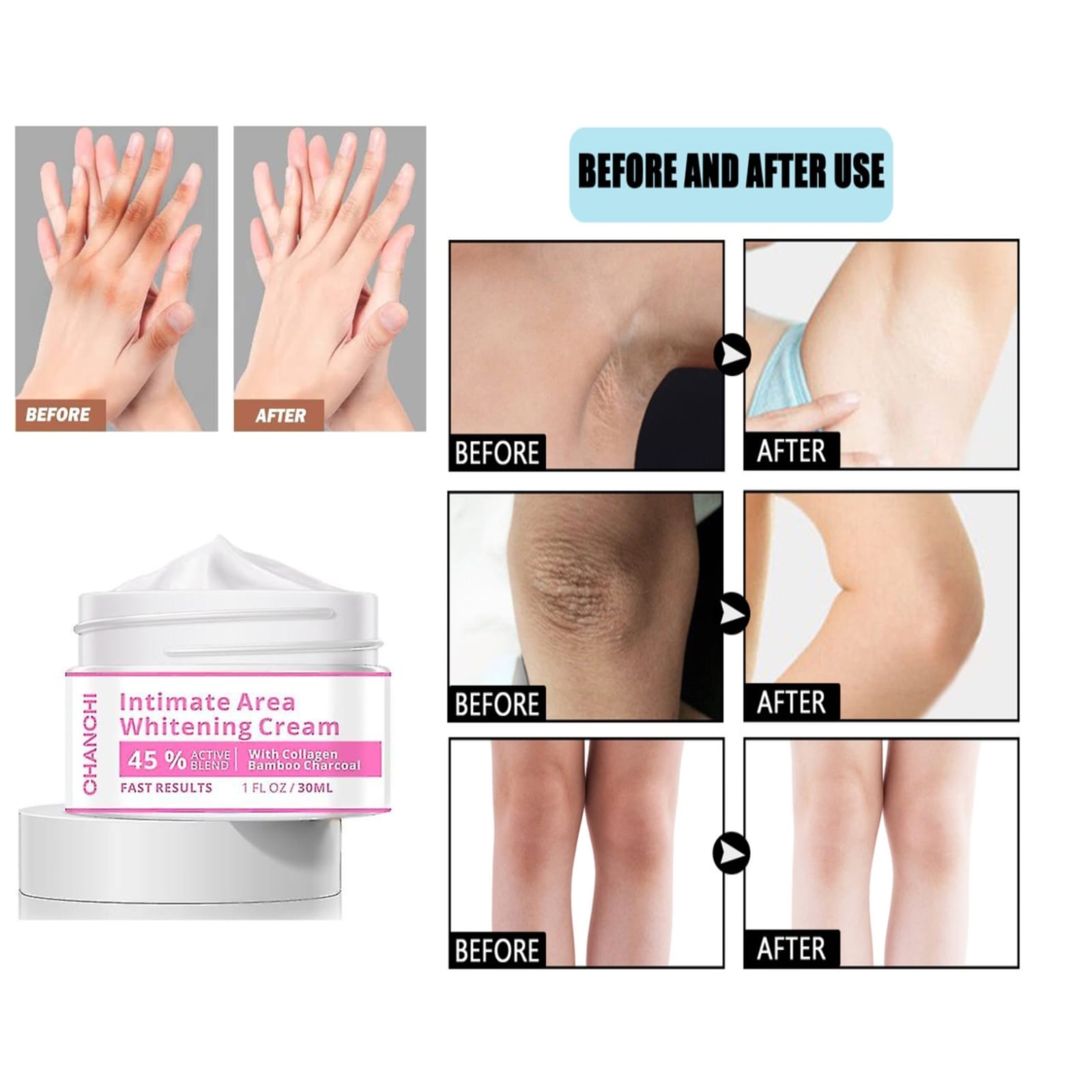 Skin Brightening Cream for Men & Women. Specially formulated to target dark spots, uneven skin tone, and dullness, this cream helps restore your skin’s natural glow while keeping it soft and hydrated.