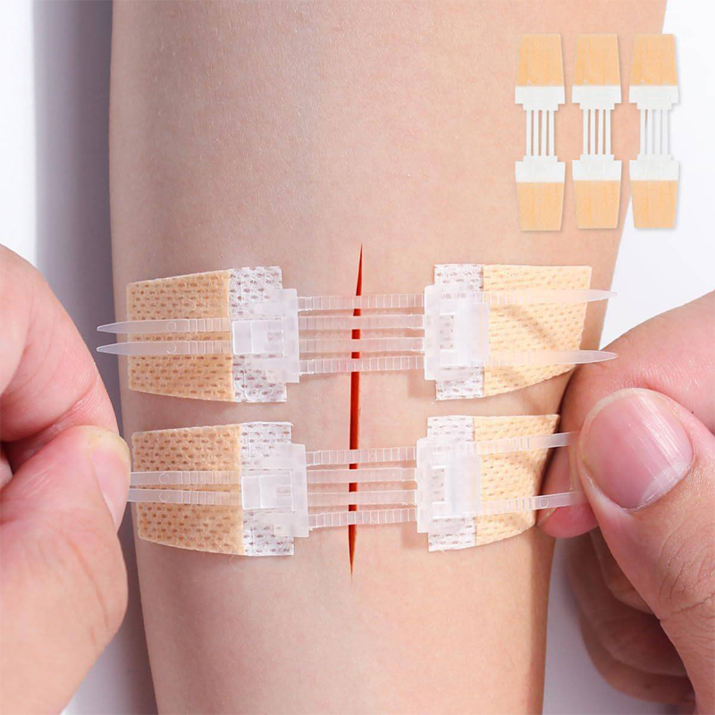 New Zipper Band-aid Painless Wound Closure Patch Zip Suture Reducer Band Aid Outdoor Portable Suture-free Wound Dressing Patches