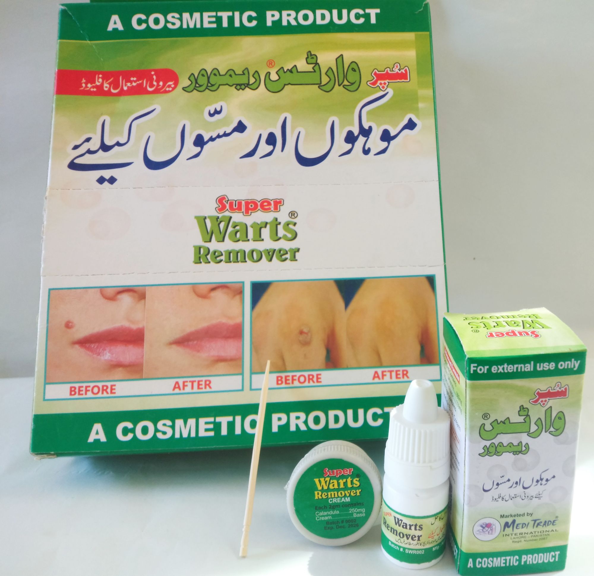 super warts Remover droper and cream