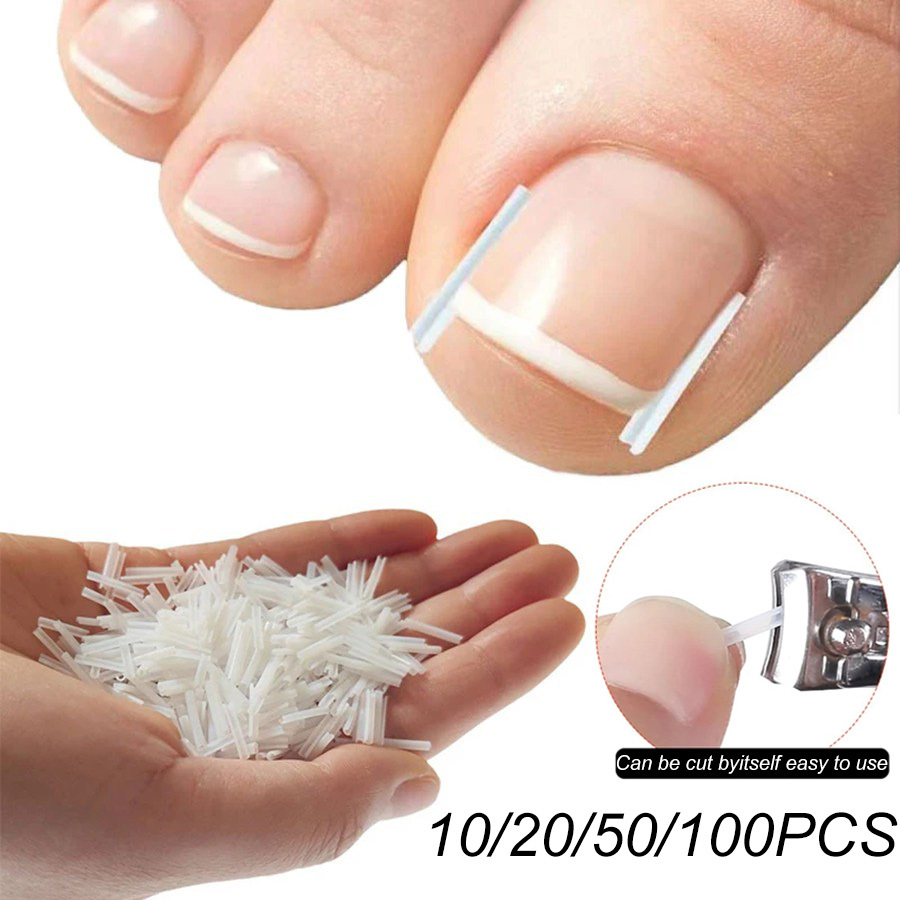Elastic C-shaped Tube Pad for Toe Nail Ingrown Toenail Corrector Tools Foot Care Invisible Groove Straightening Clip Treatment